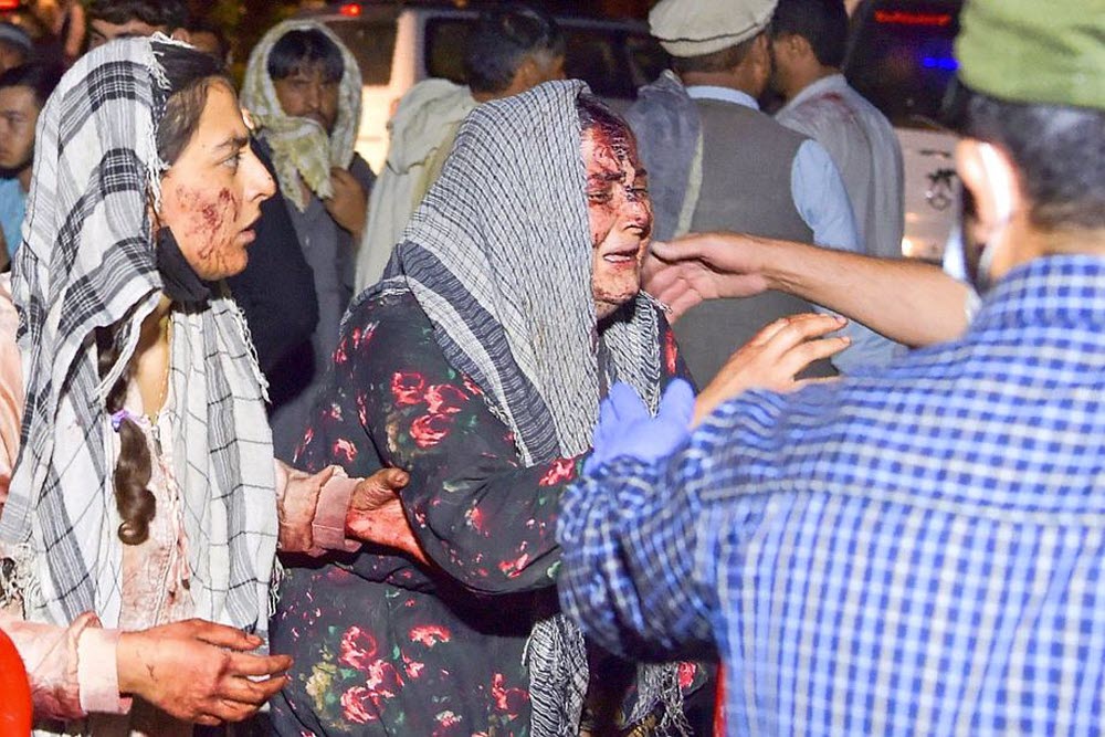 Attentat à Kaboul : au moins 72 morts et plus de 150 blessés