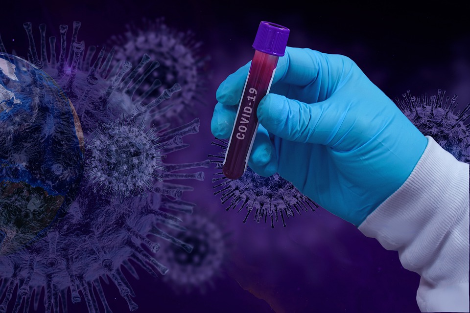 Coronavirus : Deux décès et 105 contaminations à la date du 18 Août 2022