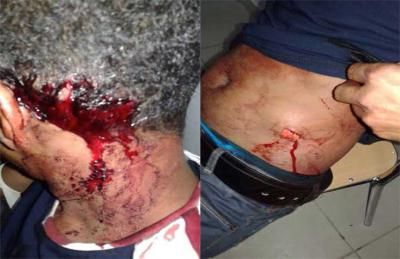Trois étudiants mauritaniens agressés à l'arme blanche à Tunis