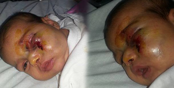 Insupportable: Un bébé violemment agressé par son propre père