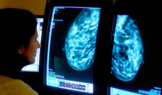 Tunisie: Plus de 2 mille nouveaux cas de cancer du sein chaque année