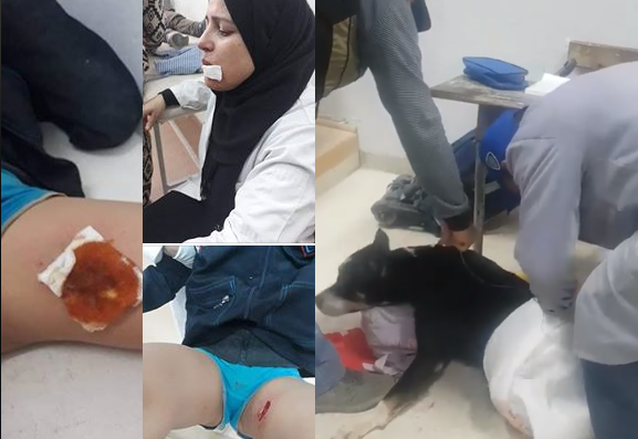 Abominable : Un pitbull attaque 8 élèves et une institutrice dans une école à Korba