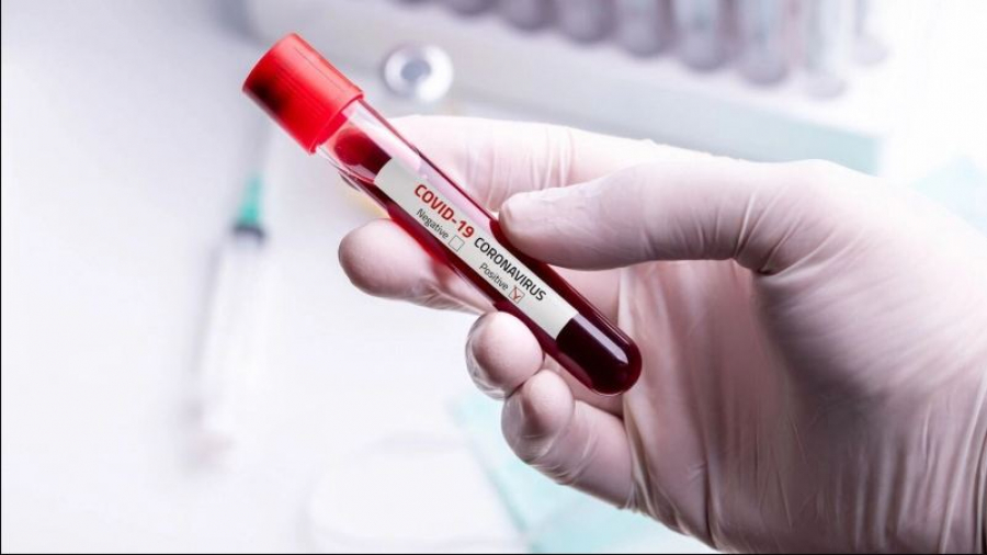 Coronavirus : 6 millions 379 mille 867 personnes entièrement vaccinées