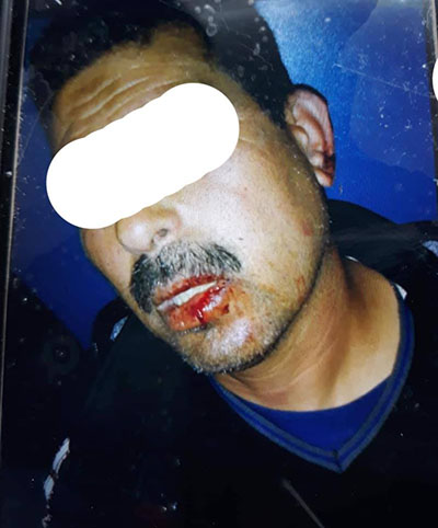 Ksar Saïd : Un gardien d'école violemment agressé par un parent d'élève (vidéo)