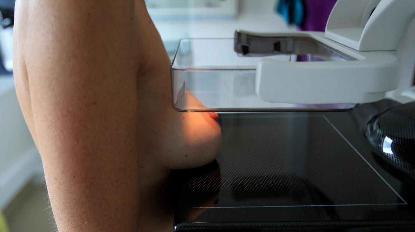 Une première mondiale: Le cancer du sein soigné en un jour