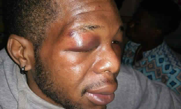 Agression raciste d'un étudiant camerounais: Ma Tunisie va mal, très mal !