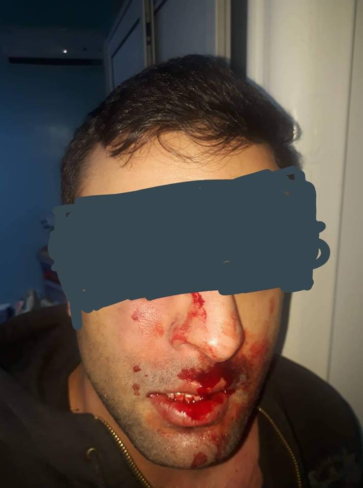 Tunisie: Encore une agression sauvage contre un médecin