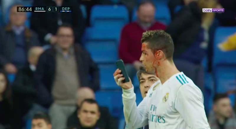En sang, Cristiano Ronaldo vérifie sa blessure sur un téléphone