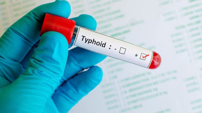 Tataouine: Le bilan des infections à la fièvre thyphoïde passe à 230