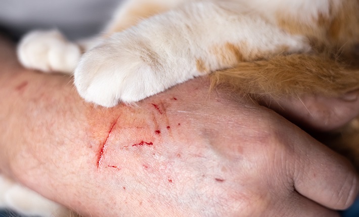 Sousse: Un bachelier de 19 ans meurt après avoir été griffé par un...chat