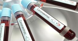 Coronavirus: 1894 nouvelles contaminations et 28 décès en une semaine