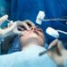 CNOM : « Les injections et actes médicaux esthétiques doivent être pratiqués par des professionnels qualifiés « 
